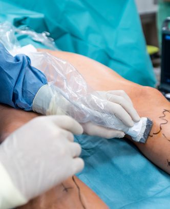 Deep Vein Thrombosis treatment in Hyderabad by Dr. Sridhar Devu at Dev Hospitals, offering advanced care and personalized treatment options.