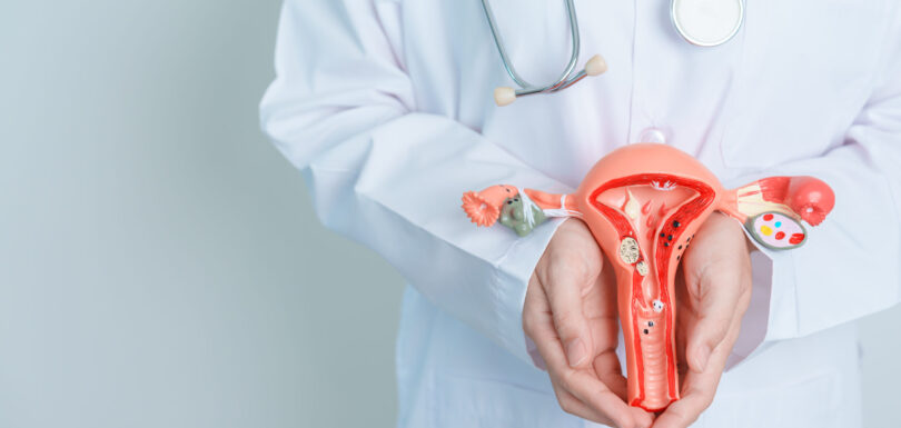 State-of-the-art facility for fibroids treatment in Hyderabad