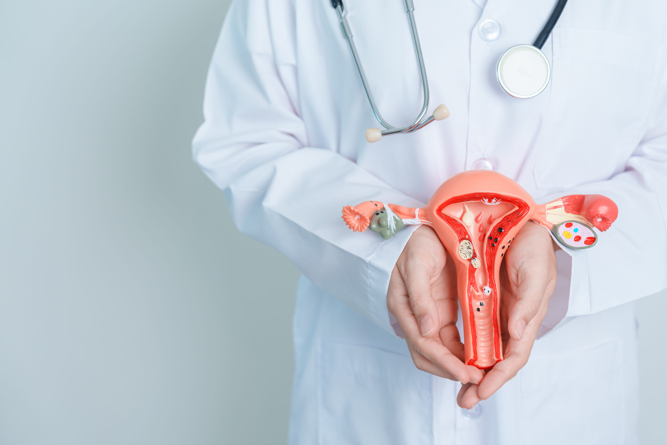 State-of-the-art facility for fibroids treatment in Hyderabad