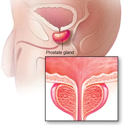 Specialist performing prostate treatment in Hyderabad using advanced medical equipment